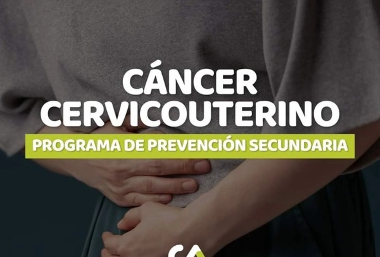 Imagen de Lanzamiento del Programa de Prevención Secundaria del Cáncer Cervicouterino en Alvear