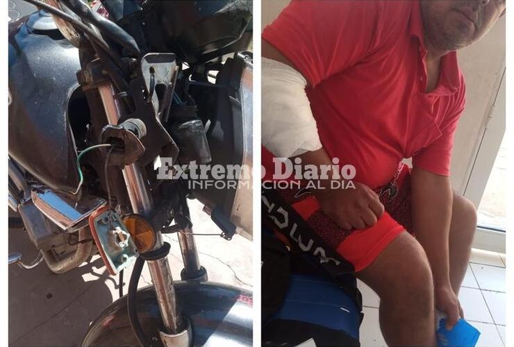 Imagen de Ruta 21: Tuvo un accidente mientras circulaba en moto y sostiene que los trabajos de obra no están bien señalizados