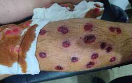 Agentes del Comando atacaron a escopetados a dos adolescentes