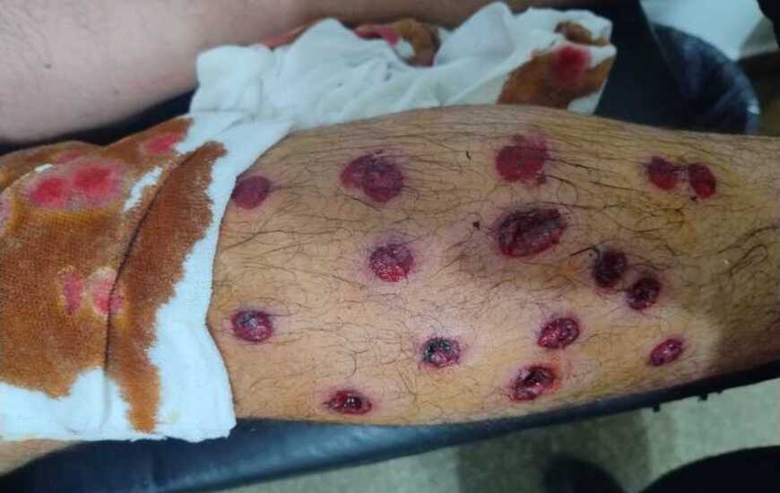 Agentes del Comando atacaron a escopetados a dos adolescentes