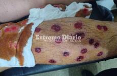 Impactante. Así le quedó la pierna a uno de los chicos