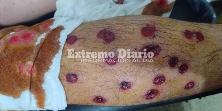 Impactante. Así le quedó la pierna a uno de los chicos