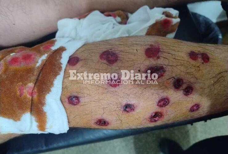 Impactante. As&iacute; le qued&oacute; la pierna a uno de los chicos