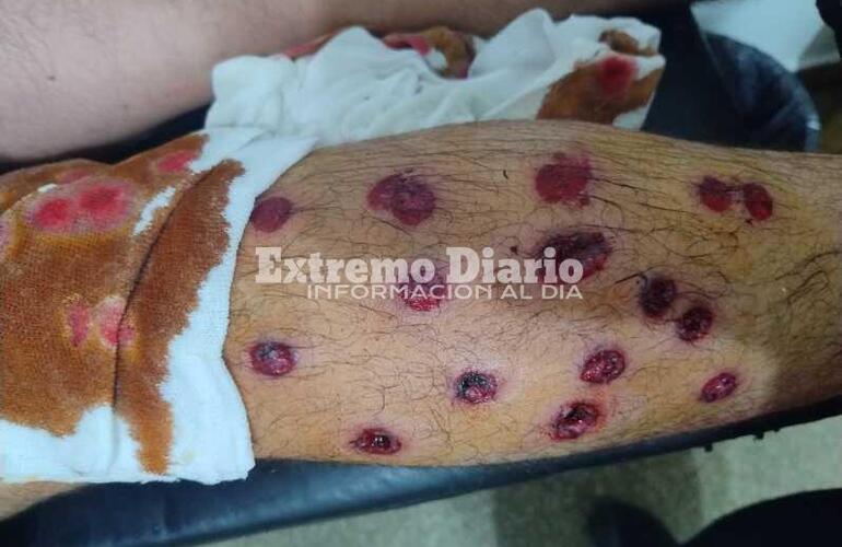Impactante. Así le quedó la pierna a uno de los chicos