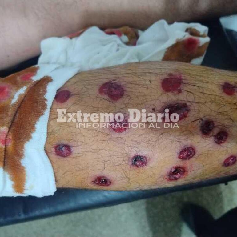 Impactante. Así le quedó la pierna a uno de los chicos