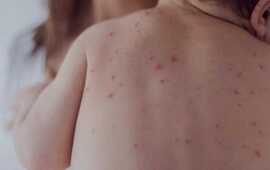 Se puso en marcha un protocolo de �vigilancia intensificada�