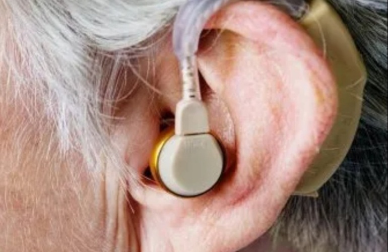 Imagen de Demoras en la entrega de audífonos y trámites del PAMI: el Concejo citó al responsable local