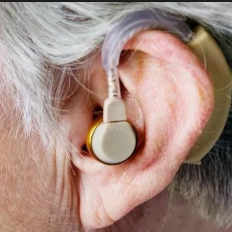 Imagen de Demoras en la entrega de audífonos y trámites del PAMI: el Concejo citó al responsable local