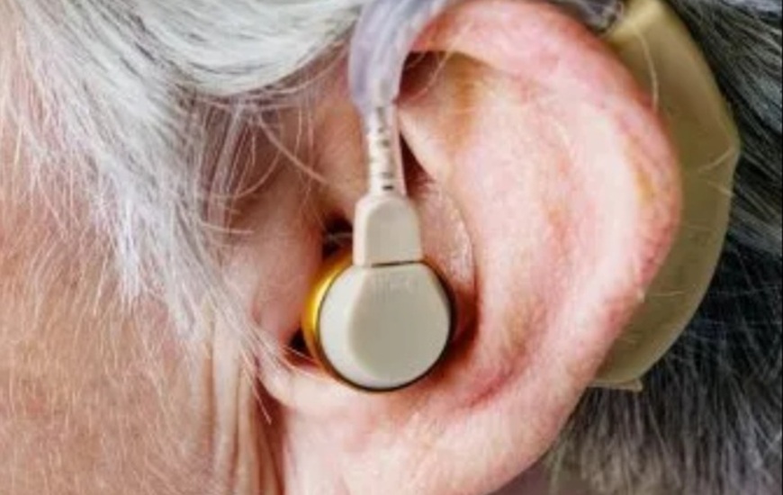 Imagen de Demoras en la entrega de audífonos y trámites del PAMI: el Concejo citó al responsable local