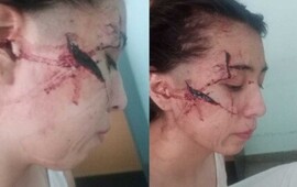 (Creditos foto Rosario3.com)