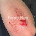 Imagen de Una joven de General Lagos choc&oacute; contra el nuevo cantero de Ruta 21 y Cardozo