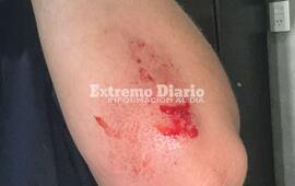 Imagen de Una joven de General Lagos choc&oacute; contra el nuevo cantero de Ruta 21 y Cardozo