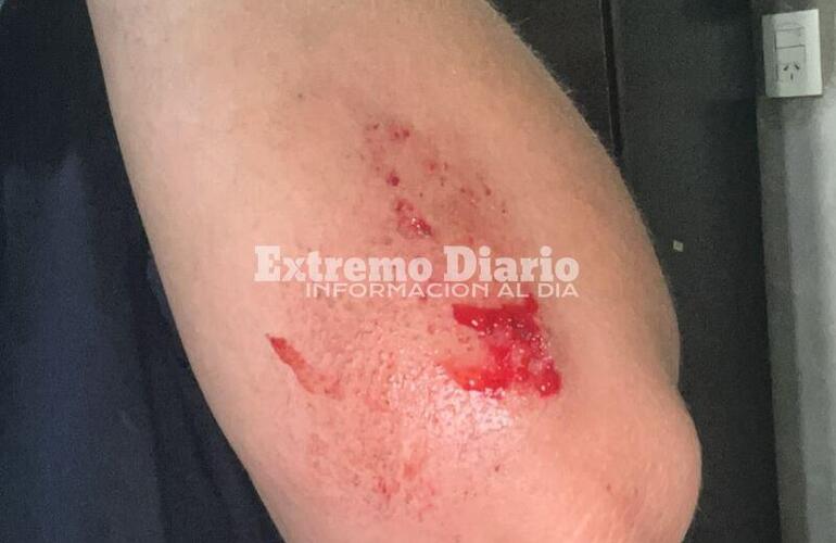 Imagen de Una joven de General Lagos choc&oacute; contra el nuevo cantero de Ruta 21 y Cardozo