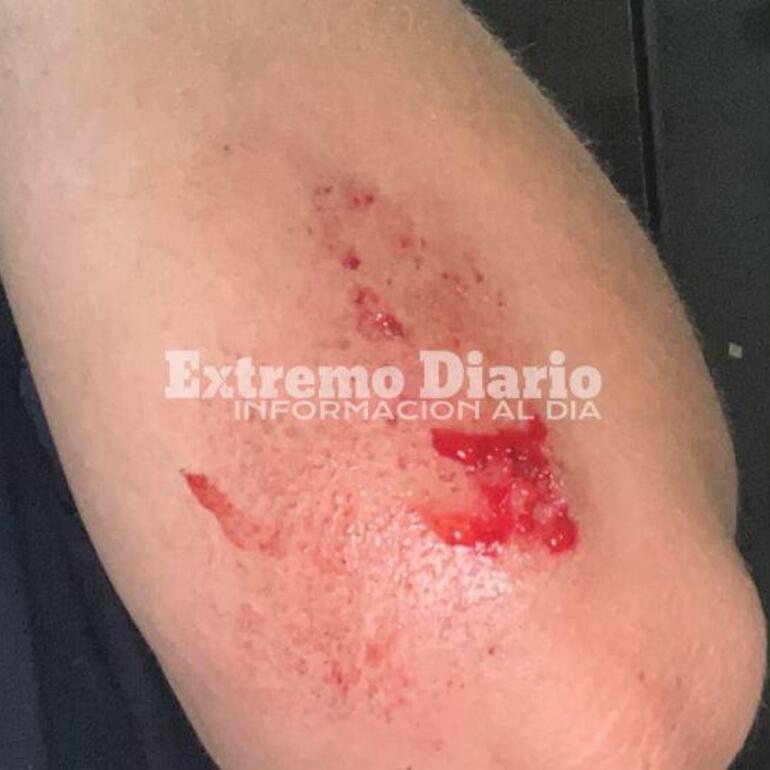 Imagen de Una joven de General Lagos choc&oacute; contra el nuevo cantero de Ruta 21 y Cardozo