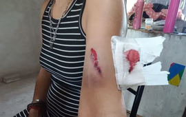 Imagen de Conmoci&oacute;n en San Jos&eacute; del Rinc&oacute;n: emboscaron y atacaron a tiros a la hermana del intendente