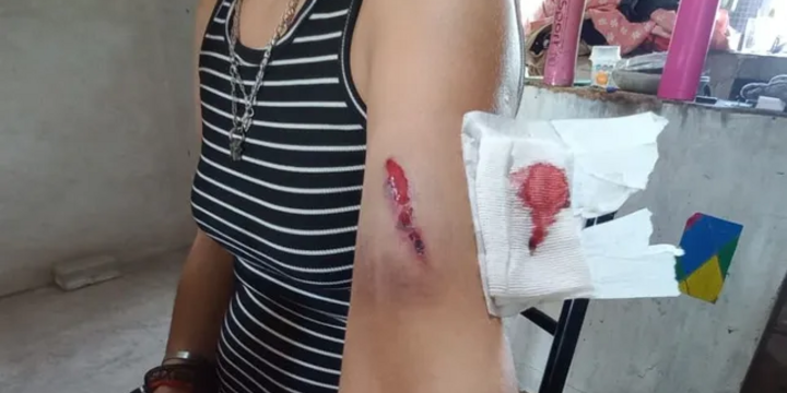 Imagen de Conmoci&oacute;n en San Jos&eacute; del Rinc&oacute;n: emboscaron y atacaron a tiros a la hermana del intendente