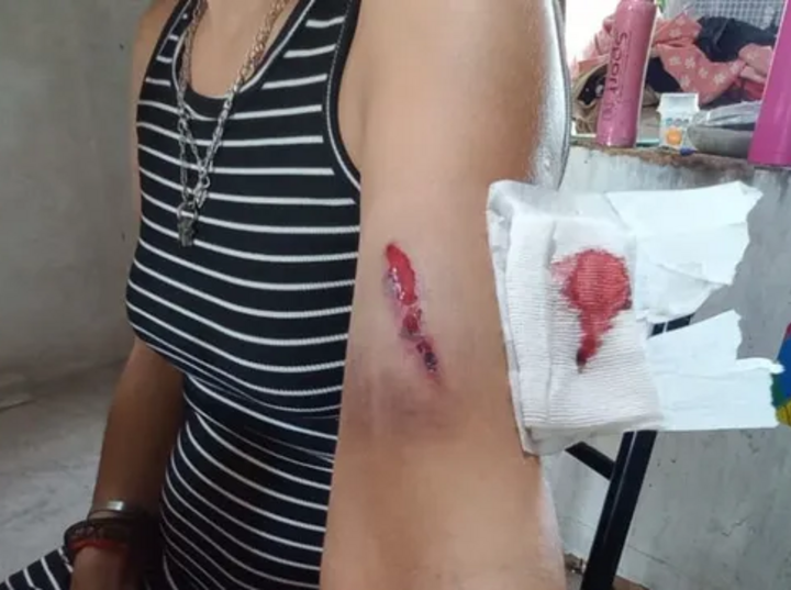 Imagen de Conmoci&oacute;n en San Jos&eacute; del Rinc&oacute;n: emboscaron y atacaron a tiros a la hermana del intendente