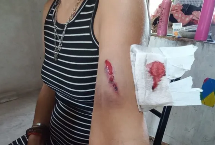 Imagen de Conmoci&oacute;n en San Jos&eacute; del Rinc&oacute;n: emboscaron y atacaron a tiros a la hermana del intendente