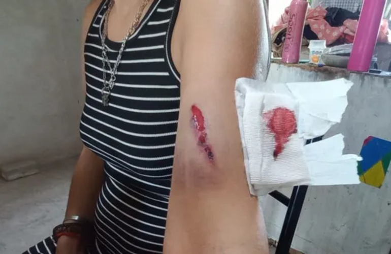 Imagen de Conmoci&oacute;n en San Jos&eacute; del Rinc&oacute;n: emboscaron y atacaron a tiros a la hermana del intendente