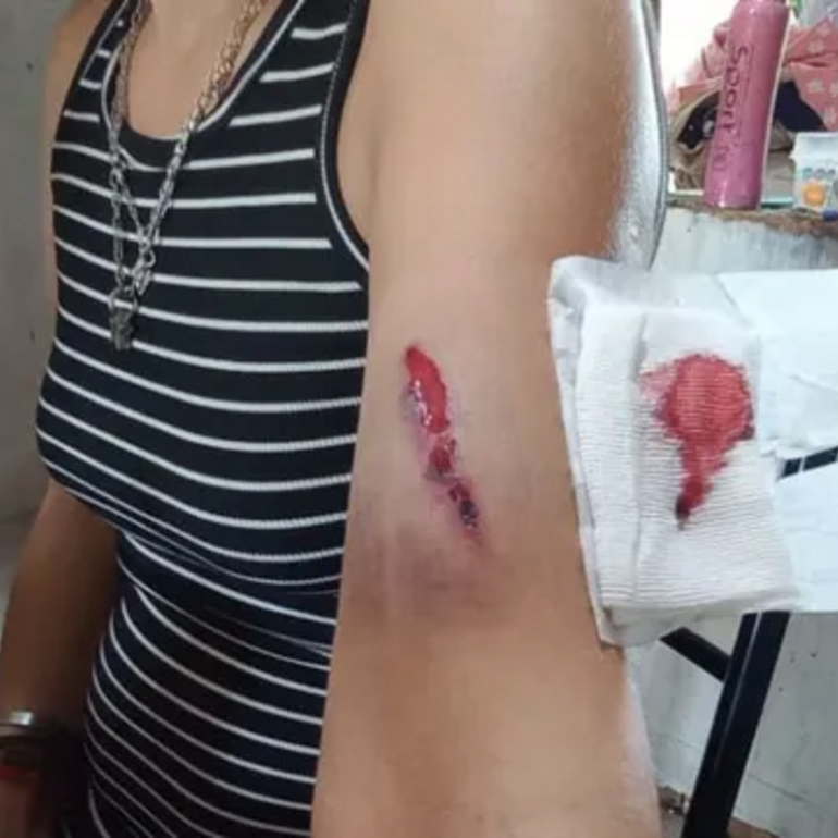 Imagen de Conmoci&oacute;n en San Jos&eacute; del Rinc&oacute;n: emboscaron y atacaron a tiros a la hermana del intendente