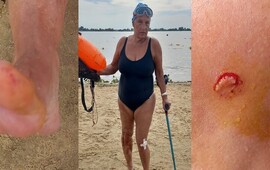 Imagen de Alerta en el rio Paran&aacute;: una palometa mordi&oacute; a una nadadora en la Rambla Catalunya