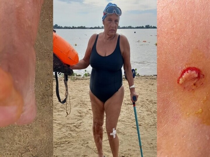 Imagen de Alerta en el rio Paran&aacute;: una palometa mordi&oacute; a una nadadora en la Rambla Catalunya