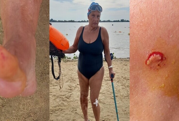 Imagen de Alerta en el rio Paran&aacute;: una palometa mordi&oacute; a una nadadora en la Rambla Catalunya