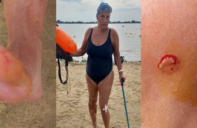 Imagen de Alerta en el rio Paran&aacute;: una palometa mordi&oacute; a una nadadora en la Rambla Catalunya