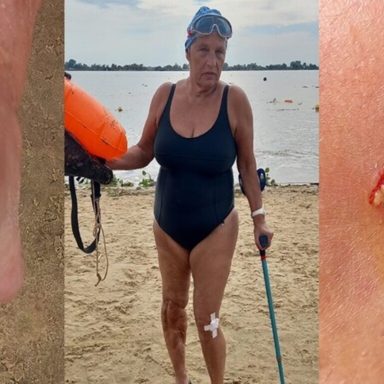 Imagen de Alerta en la costa: una palometa mordi&oacute; a una nadadora en la Rambla Catalunya