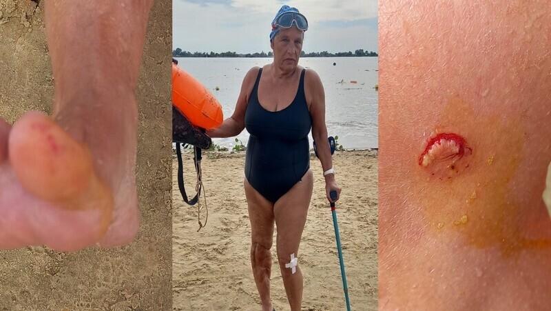 Imagen de Alerta en el rio Paran&aacute;: una palometa mordi&oacute; a una nadadora en la Rambla Catalunya