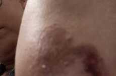 Imagen de Vecina de Arroyo Seco denuncia incidentes con perros callejeros frente a una remiser&iacute;a local