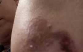 Imagen de Vecina de Arroyo Seco denuncia incidentes con perros callejeros frente a una remiser&iacute;a local