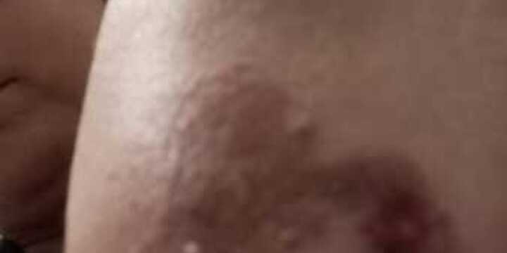 Imagen de Vecina de Arroyo Seco denuncia incidentes con perros callejeros frente a una remiser&iacute;a local