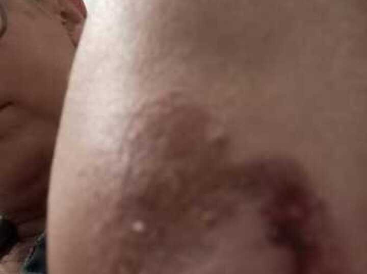 Imagen de Vecina de Arroyo Seco denuncia incidentes con perros callejeros frente a una remiser&iacute;a local