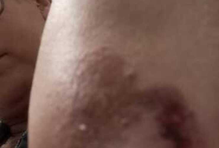 Imagen de Vecina de Arroyo Seco denuncia incidentes con perros callejeros frente a una remiser&iacute;a local