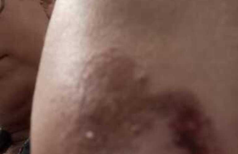 Imagen de Vecina de Arroyo Seco denuncia incidentes con perros callejeros frente a una remiser&iacute;a local