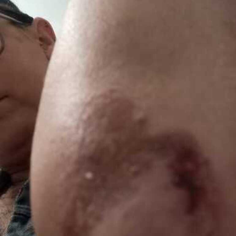 Imagen de Vecina de Arroyo Seco denuncia incidentes con perros callejeros frente a una remiser&iacute;a local