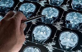 Imagen de Esperanza contra el Alzheimer: Cient&iacute;ficas del Conicet desarrollan una prometedora terapia experimental