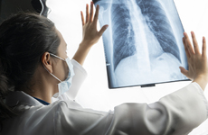 Imagen de Alerta sanitaria: la tuberculosis, una enfermedad antigua que recobra fuerza en la regi&oacute;n