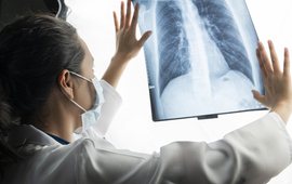 Imagen de Alerta sanitaria: la tuberculosis, una enfermedad antigua que recobra fuerza en la regi&oacute;n