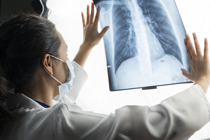 Imagen de Alerta sanitaria: la tuberculosis, una enfermedad antigua que recobra fuerza en la regi&oacute;n