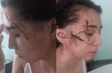 Imagen de Los agresores de Delfina, la joven brutalmente atacada a cuchillazos en enero pasado, eran compa&ntilde;eros del tirador