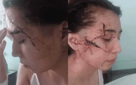 Imagen de Los agresores de Delfina, la joven brutalmente atacada a cuchillazos en enero pasado, eran compa&ntilde;eros del tirador