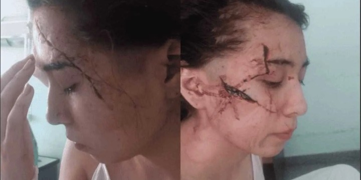 Imagen de Los agresores de Delfina, la joven brutalmente atacada a cuchillazos en enero pasado, eran compa&ntilde;eros del tirador