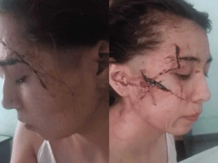 Imagen de Los agresores de Delfina, la joven brutalmente atacada a cuchillazos en enero pasado, eran compa&ntilde;eros del tirador