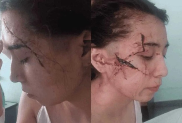 Imagen de Los agresores de Delfina, la joven brutalmente atacada a cuchillazos en enero pasado, eran compa&ntilde;eros del tirador