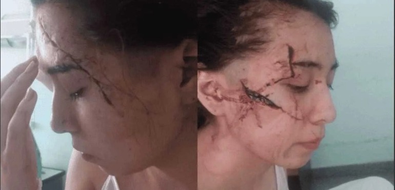 Imagen de Los agresores de Delfina, la joven brutalmente atacada a cuchillazos en enero pasado, eran compa&ntilde;eros del tirador