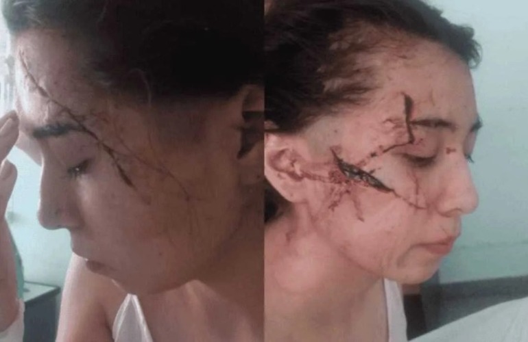 Imagen de Los agresores de Delfina, la joven brutalmente atacada a cuchillazos en enero pasado, eran compa&ntilde;eros del tirador