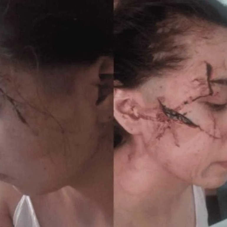 Imagen de Los agresores de Delfina, la joven brutalmente atacada a cuchillazos en enero pasado, eran compa&ntilde;eros del tirador