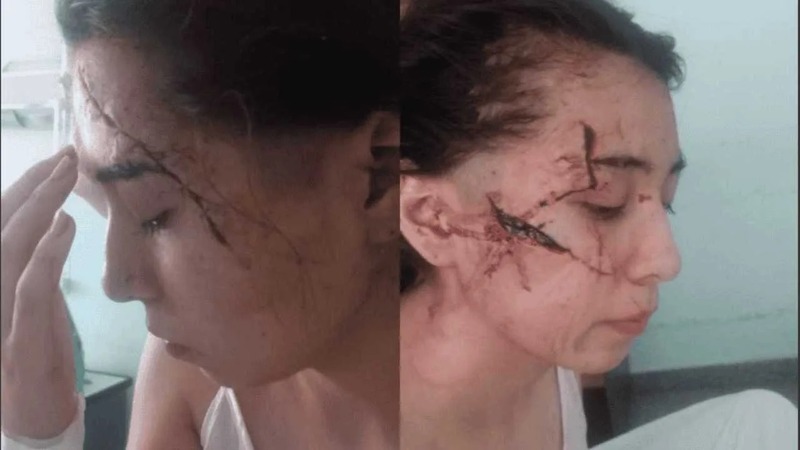 Imagen de Los agresores de Delfina, la joven brutalmente atacada a cuchillazos en enero pasado, eran compa&ntilde;eros del tirador